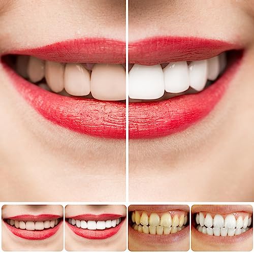 SP-4 Whitening Toothpaste | Gulf e Shop